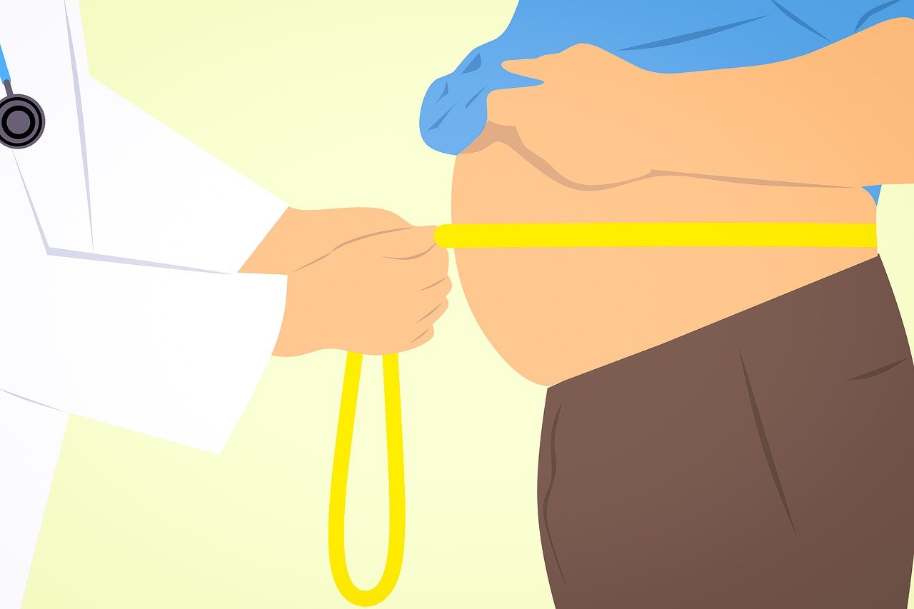 What is Bariatric Surgery?