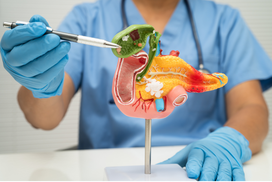 Gallbladder Stones: Symptoms, Causes and Treatment Options