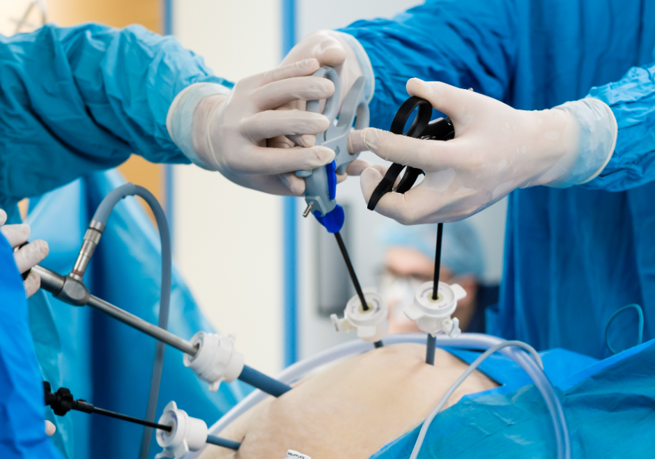 Laparoscopic Hernia Surgery vs Open Surgery: Which Is Better?